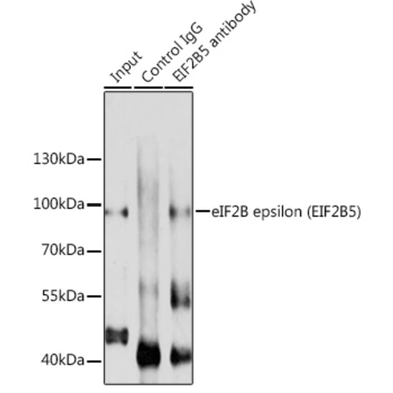 Western Blot - Anti-EIF2B5 Antibody (A12870) - Antibodies.com