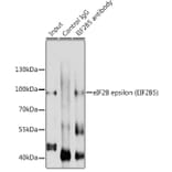 Western Blot - Anti-EIF2B5 Antibody (A12870) - Antibodies.com