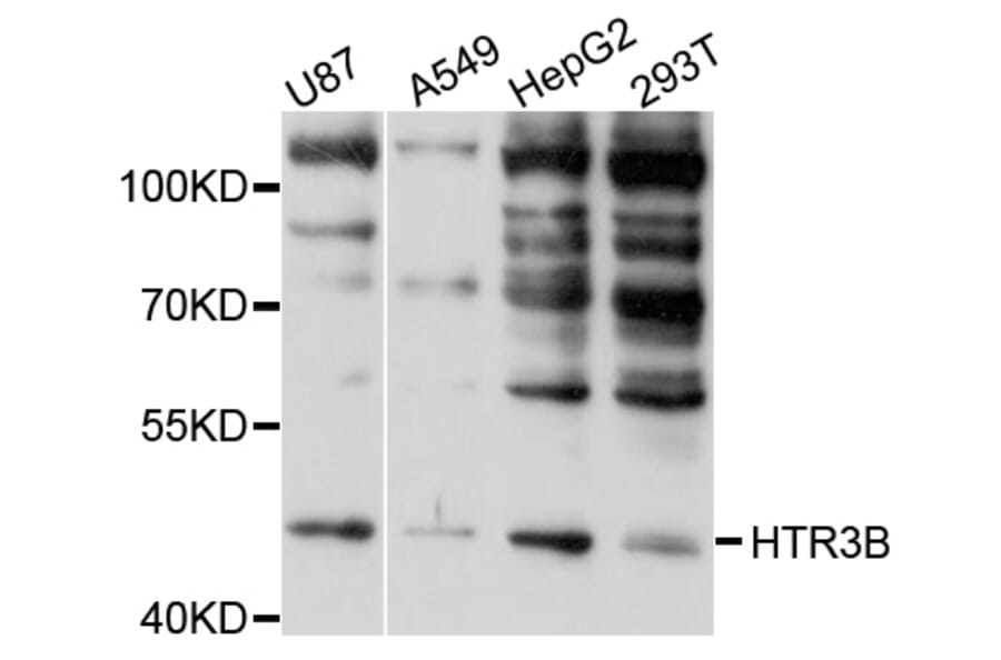 Western Blot - Anti-HTR3B Antibody (A10266) - Antibodies.com
