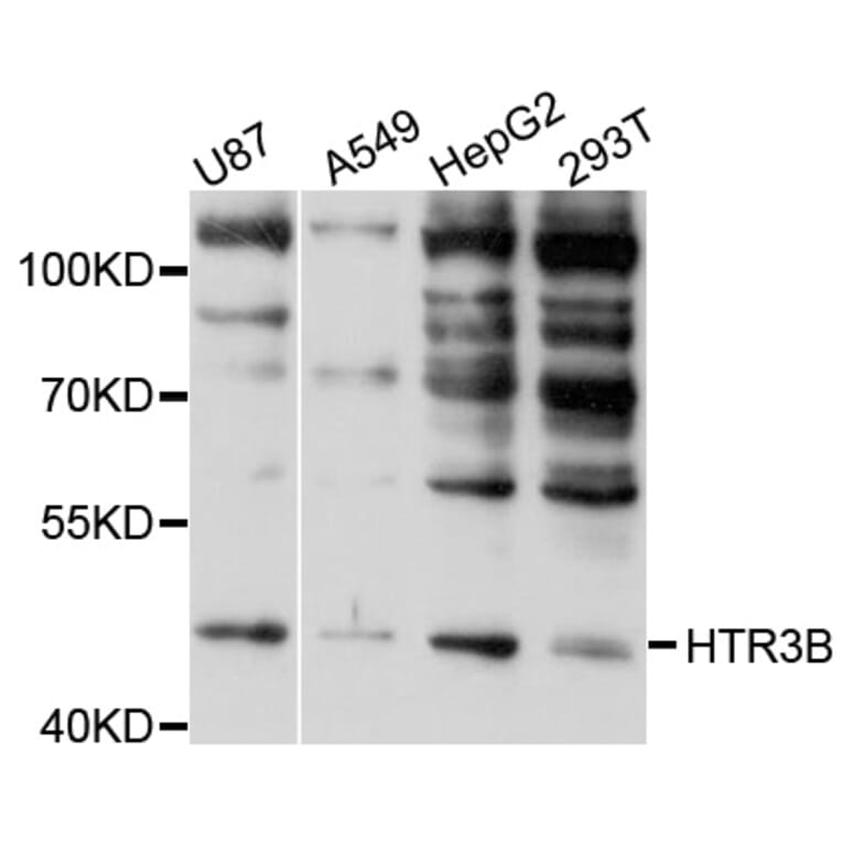 Western Blot - Anti-HTR3B Antibody (A10266) - Antibodies.com