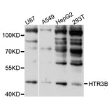 Western Blot - Anti-HTR3B Antibody (A10266) - Antibodies.com