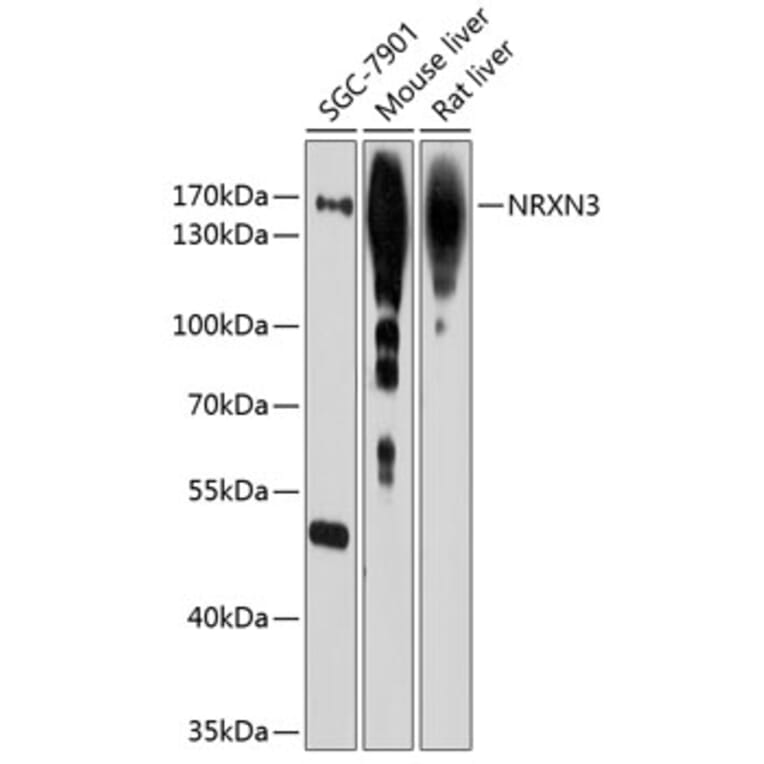 Western Blot - Anti-NRXN3 Antibody (A12872) - Antibodies.com