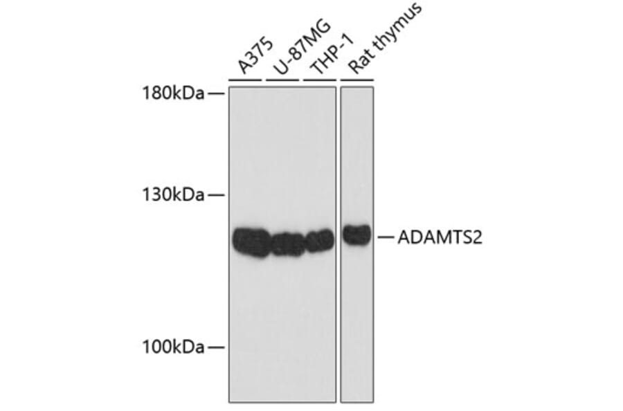 Western Blot - Anti-ADAMTS2/NPI Antibody (A12873) - Antibodies.com
