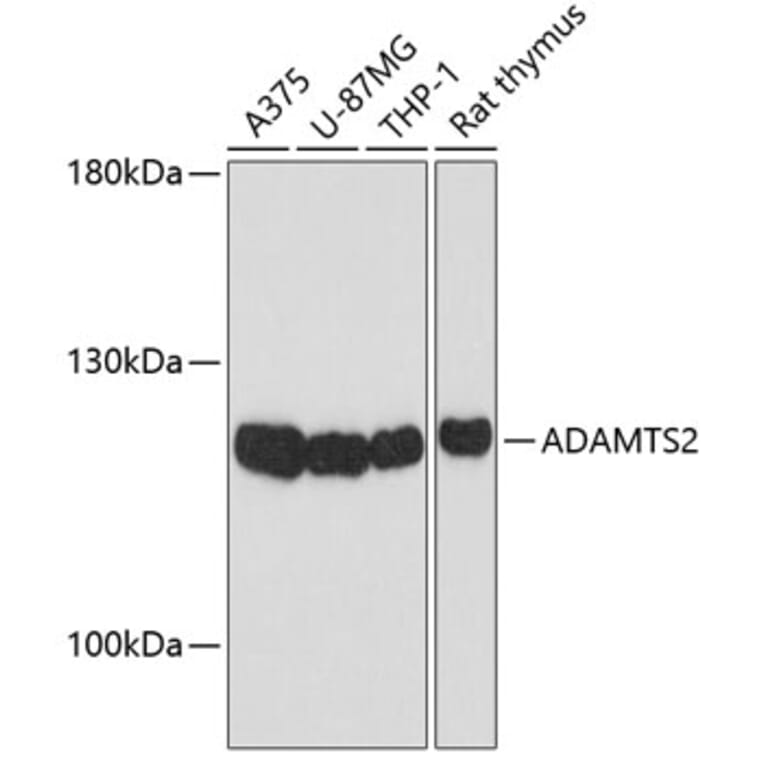 Western Blot - Anti-ADAMTS2/NPI Antibody (A12873) - Antibodies.com