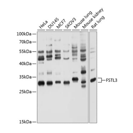 Western Blot - Anti-FSTL3 Antibody (A12875) - Antibodies.com