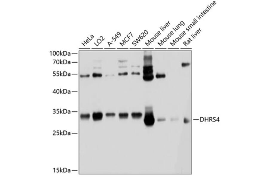 Western Blot - Anti-DHRS4 Antibody (A12876) - Antibodies.com