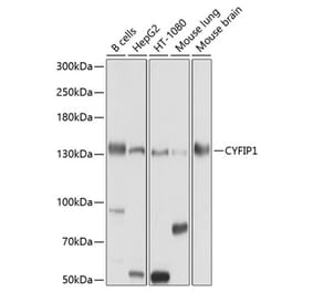 Western Blot - Anti-CYFIP1 Antibody (A12878) - Antibodies.com