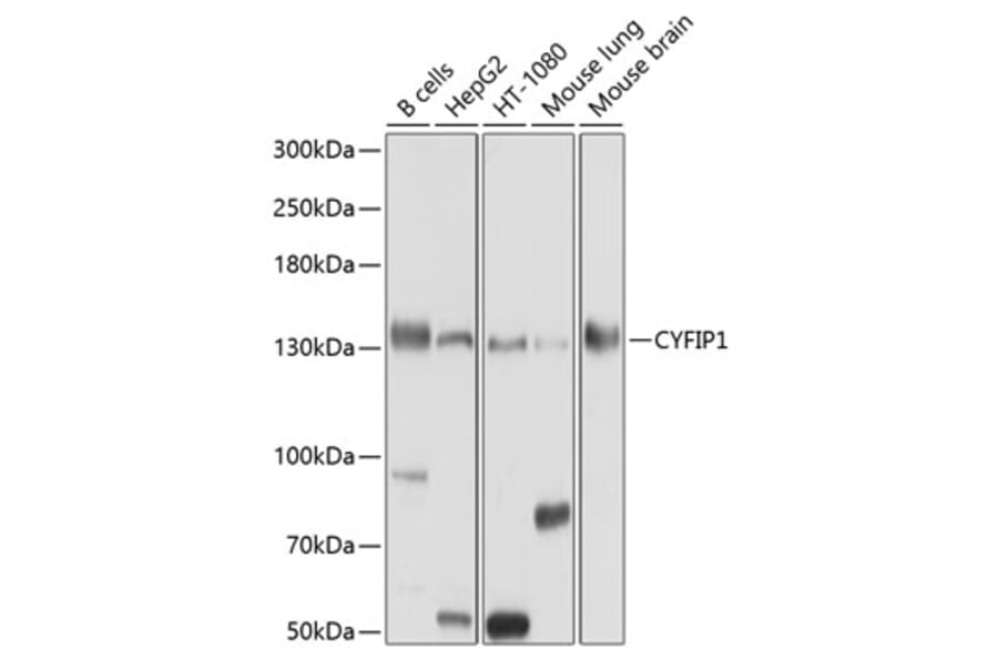 Western Blot - Anti-CYFIP1 Antibody (A12878) - Antibodies.com