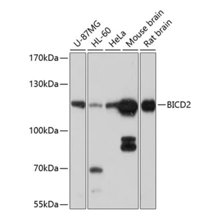 Western Blot - Anti-BICD2 Antibody (A12879) - Antibodies.com