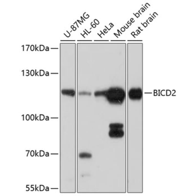 Western Blot - Anti-BICD2 Antibody (A12879) - Antibodies.com