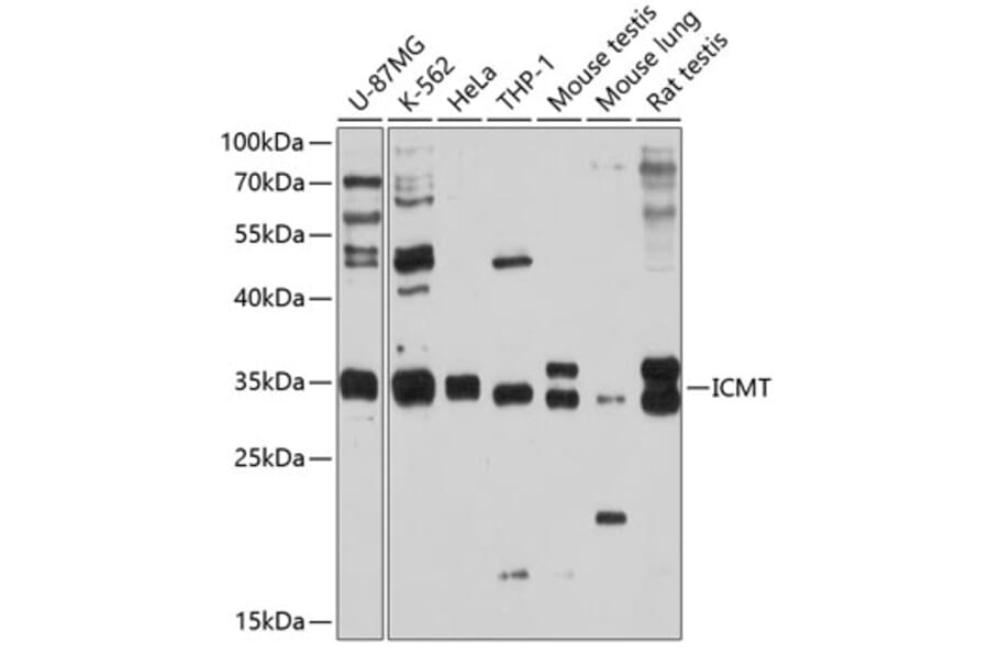 Western Blot - Anti-ICMT Antibody (A12880) - Antibodies.com