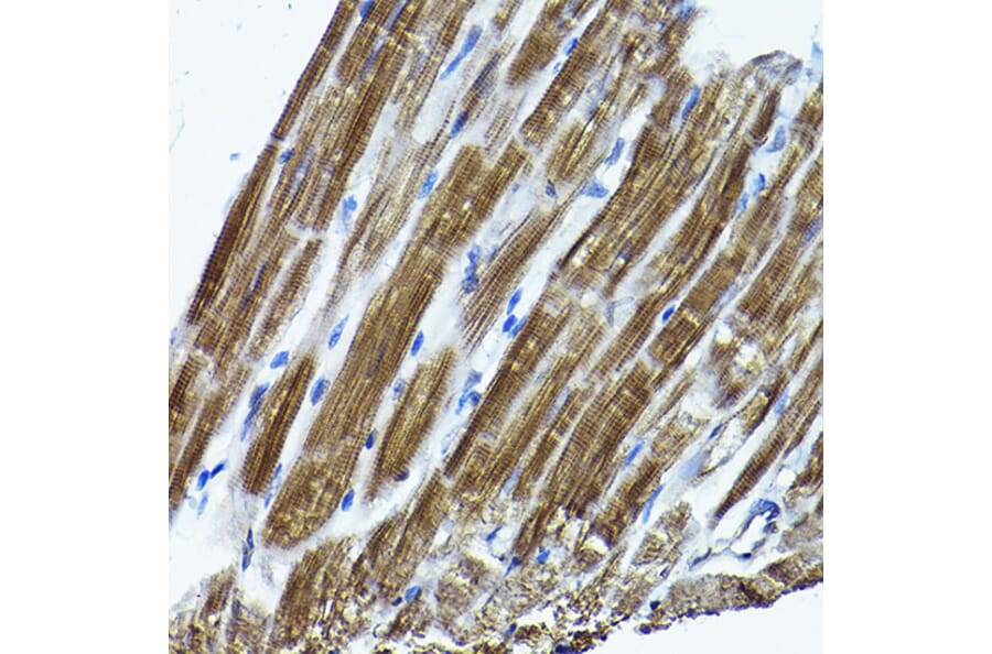 Immunohistochemistry - Anti-ICMT Antibody (A12880) - Antibodies.com