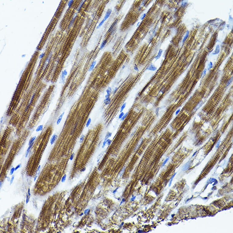 Immunohistochemistry - Anti-ICMT Antibody (A12880) - Antibodies.com