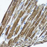 Immunohistochemistry - Anti-ICMT Antibody (A12880) - Antibodies.com