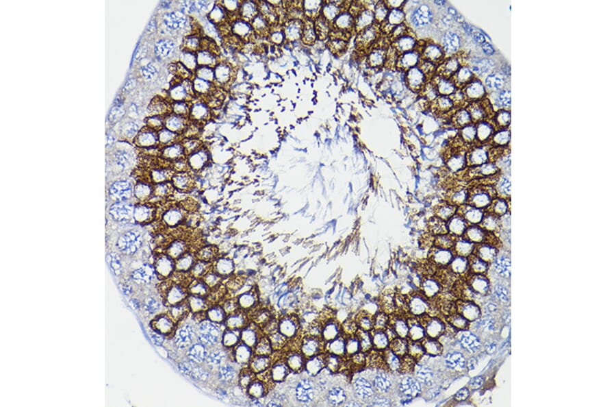 Immunohistochemistry - Anti-ICMT Antibody (A12880) - Antibodies.com