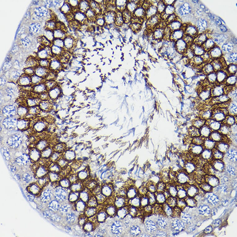 Immunohistochemistry - Anti-ICMT Antibody (A12880) - Antibodies.com