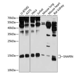 Western Blot - Anti-SNAPIN Antibody (A12881) - Antibodies.com