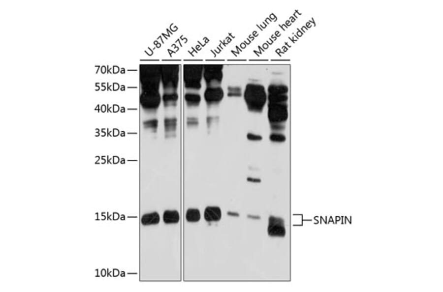 Western Blot - Anti-SNAPIN Antibody (A12881) - Antibodies.com