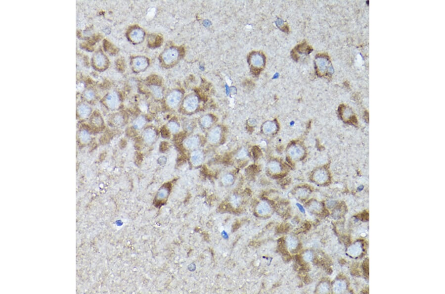 Immunohistochemistry - Anti-SNAPIN Antibody (A12881) - Antibodies.com