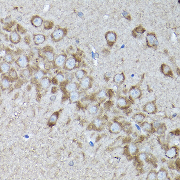Immunohistochemistry - Anti-SNAPIN Antibody (A12881) - Antibodies.com