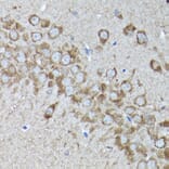 Immunohistochemistry - Anti-SNAPIN Antibody (A12881) - Antibodies.com