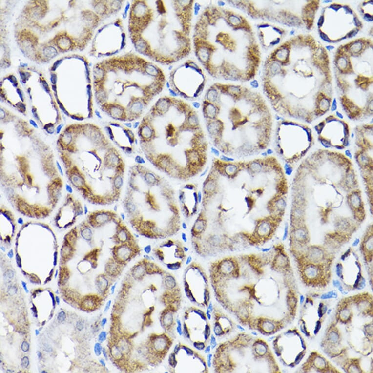 Immunohistochemistry - Anti-SNAPIN Antibody (A12881) - Antibodies.com