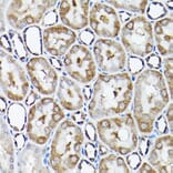 Immunohistochemistry - Anti-SNAPIN Antibody (A12881) - Antibodies.com