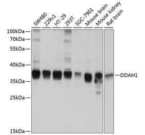 Western Blot - Anti-DDAH1 Antibody (A12882) - Antibodies.com