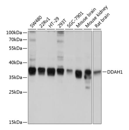 Western Blot - Anti-DDAH1 Antibody (A12882) - Antibodies.com