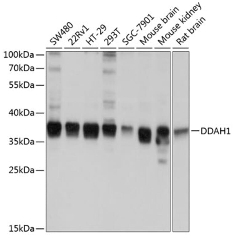 Western Blot - Anti-DDAH1 Antibody (A12882) - Antibodies.com