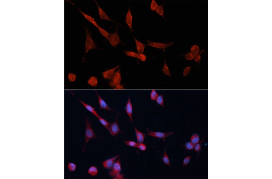 Immunofluorescence - Anti-DDAH1 Antibody (A12882) - Antibodies.com