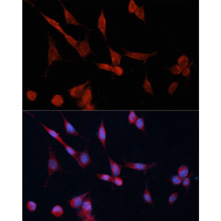 Immunofluorescence - Anti-DDAH1 Antibody (A12882) - Antibodies.com