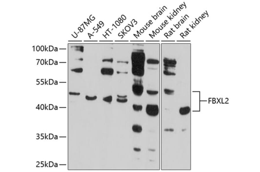 Western Blot - Anti-FBXL2 Antibody (A12883) - Antibodies.com
