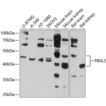 Western Blot - Anti-FBXL2 Antibody (A12883) - Antibodies.com
