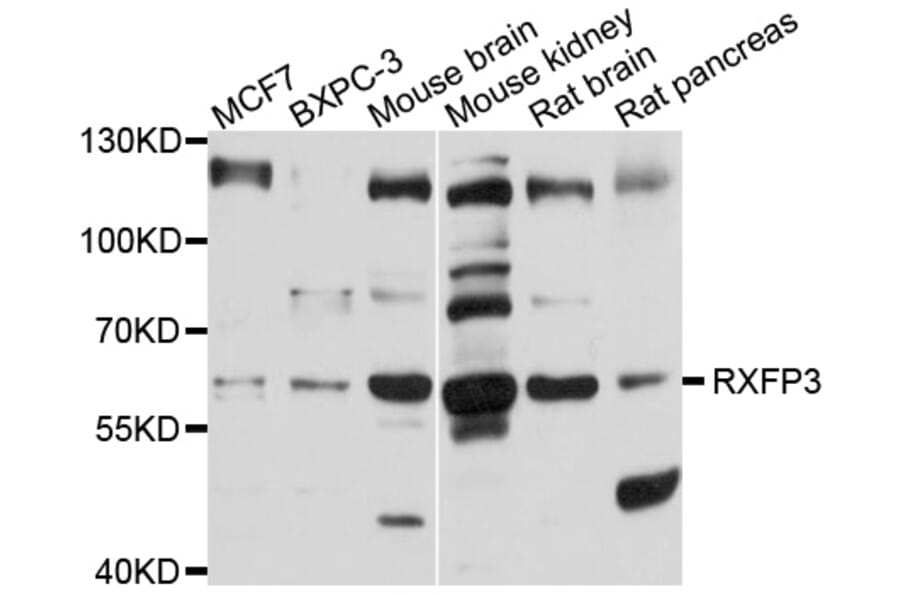 Western Blot - Anti-RXFP3 Antibody (A10303) - Antibodies.com