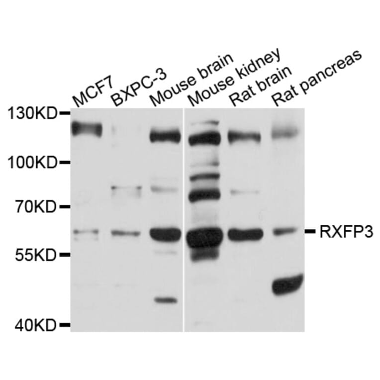 Western Blot - Anti-RXFP3 Antibody (A10303) - Antibodies.com