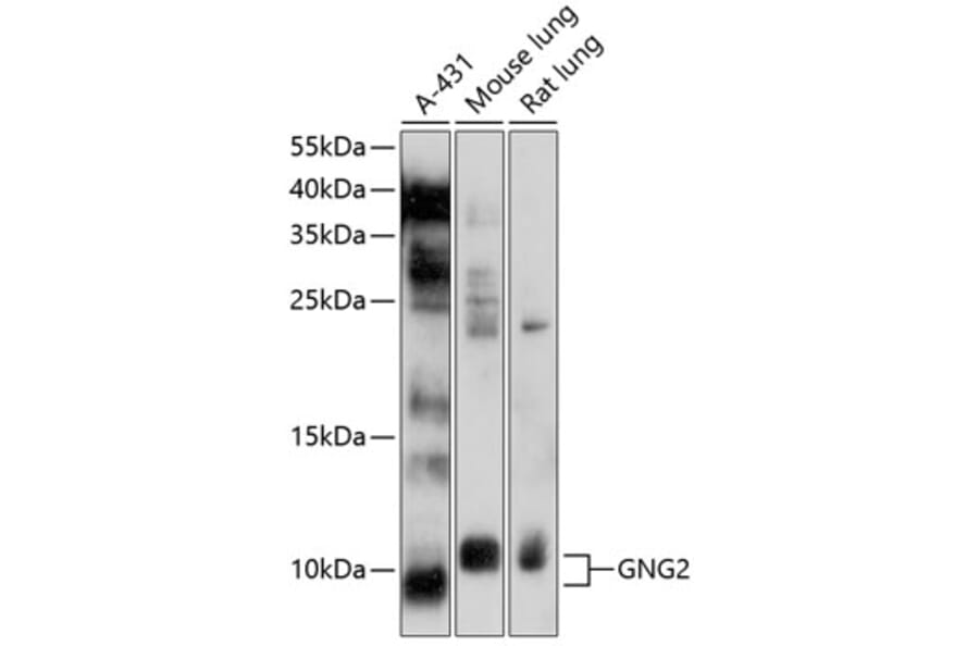 Western Blot - Anti-GNG2 Antibody (A12885) - Antibodies.com