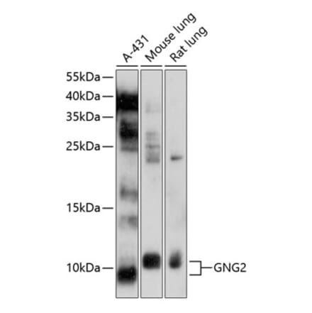 Western Blot - Anti-GNG2 Antibody (A12885) - Antibodies.com