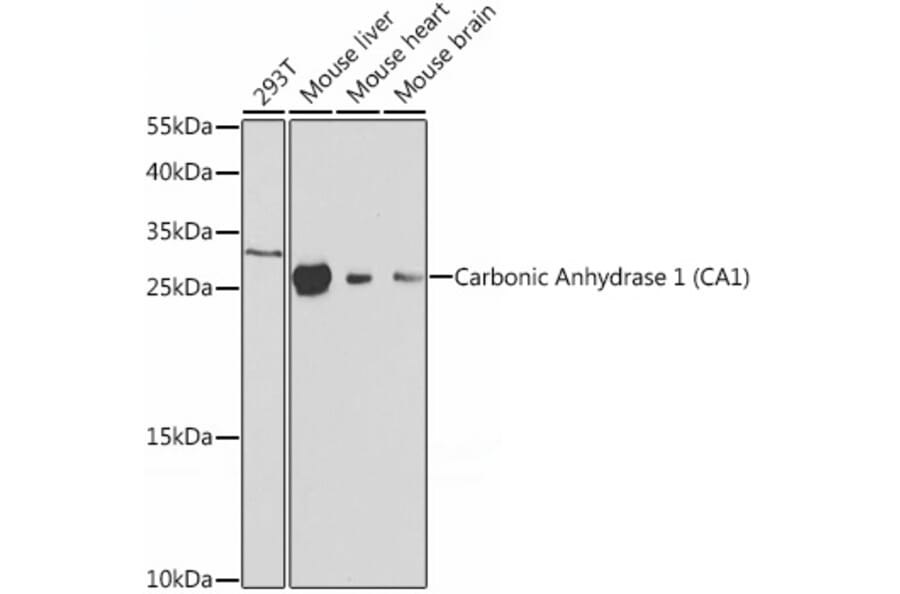 Western Blot - Anti-Carbonic Anhydrase 1/CA1 Antibody (A12886) - Antibodies.com