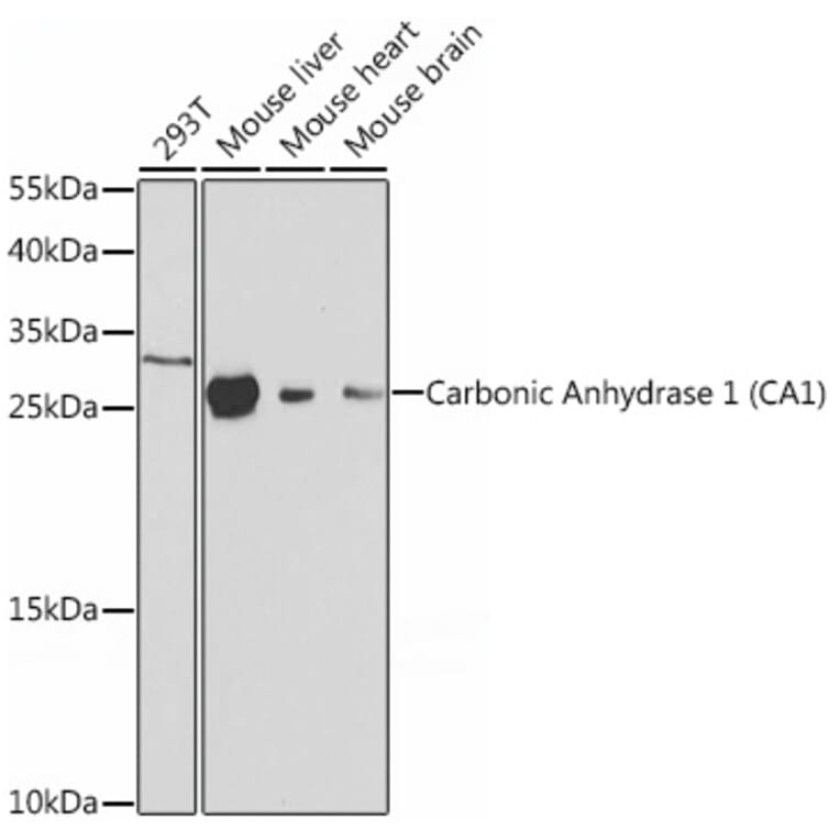 Western Blot - Anti-Carbonic Anhydrase 1/CA1 Antibody (A12886) - Antibodies.com