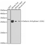 Western Blot - Anti-Carbonic Anhydrase 1/CA1 Antibody (A12886) - Antibodies.com