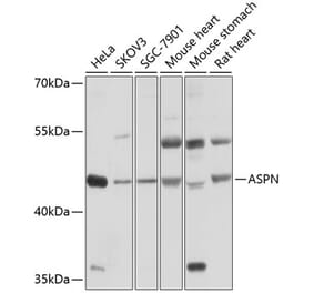 Western Blot - Anti-Asporin Antibody (A12887) - Antibodies.com