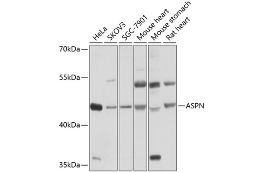 Western Blot - Anti-Asporin Antibody (A12887) - Antibodies.com