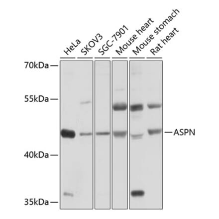 Western Blot - Anti-Asporin Antibody (A12887) - Antibodies.com