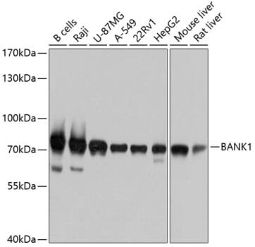 Western blot analysis of extracts of various cell lines, using Anti-BANK1 Antibody (A10312) at 1:1,000 dilution.
Secondary antibody: Goat Anti-Rabbit IgG (H+L) (HRP) (AS014) at 1:10,000 dilution.
Lysates / proteins: 25µg per lane.
Blocking buffer: 3% non-fat dry milk in TBST.
Detection: ECL Basic Kit (RM00020).
Exposure time: 3s.