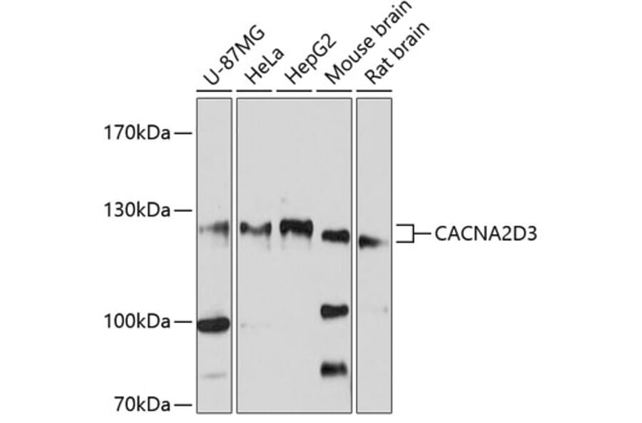 Western Blot - Anti-CACNA2D3 Antibody (A12889) - Antibodies.com