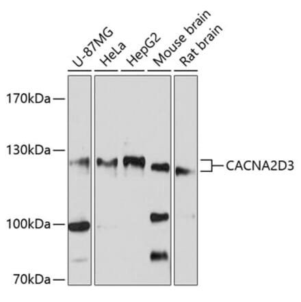 Western Blot - Anti-CACNA2D3 Antibody (A12889) - Antibodies.com