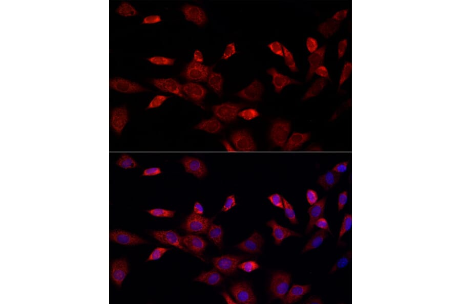 Immunofluorescence - Anti-MitoNEET Antibody (A12890) - Antibodies.com