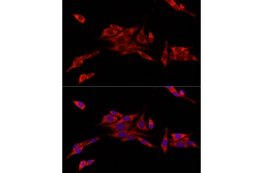 Immunofluorescence - Anti-MitoNEET Antibody (A12890) - Antibodies.com