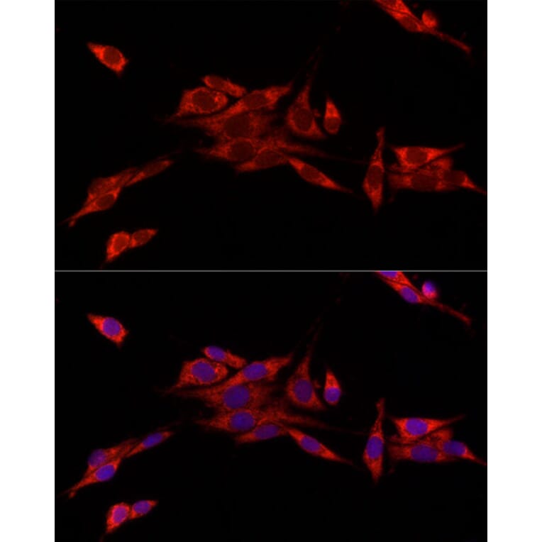 Immunofluorescence - Anti-MitoNEET Antibody (A12890) - Antibodies.com